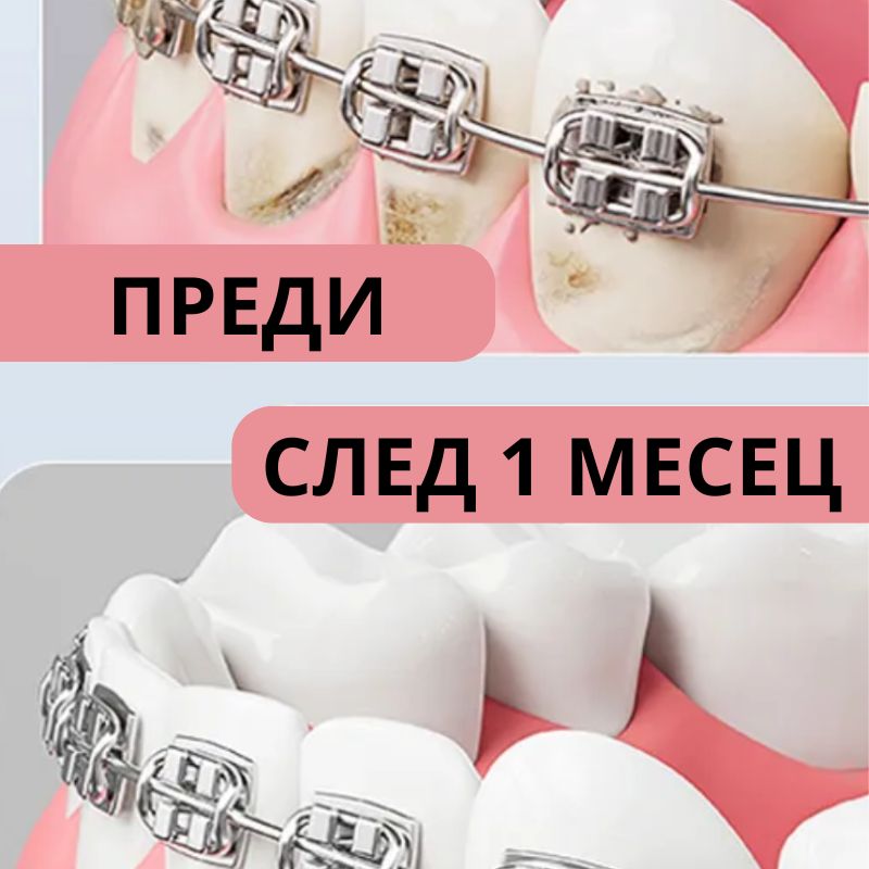 Реминерализираща паста за зъби против кариеси с флуорид 1450 ppm Vussen C Cavity Toothpaste