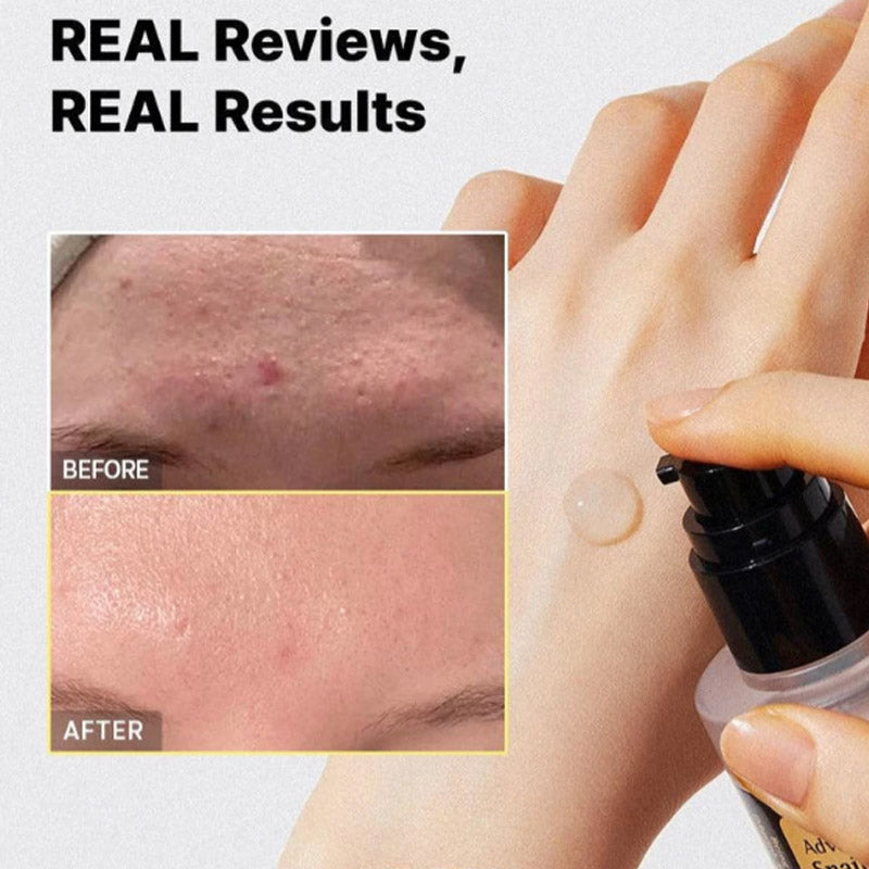 Есенция за лице с 96% охлювен муцин COSRX Advanced Snail 96 Mucin Power Essence