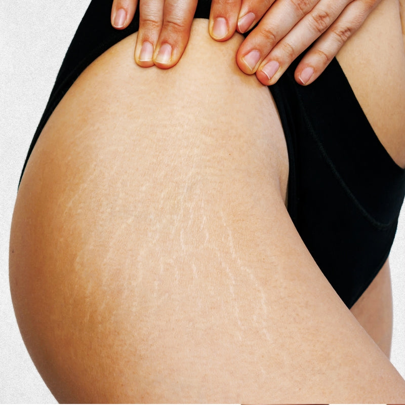 Коктейл против стрии с кейл и нар Farmona Green menu Stretch Mark Removing Body Cocktail