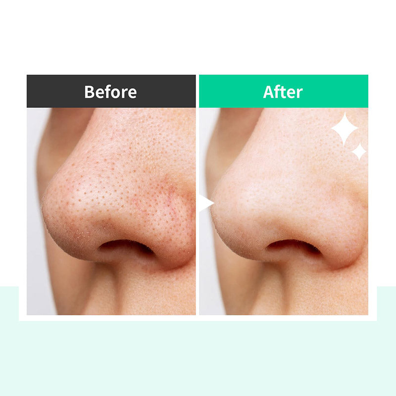 Почистващо олио за свиване на порите с Хотуния OOTD Heartleaf Pore Zero Cleansing Oil