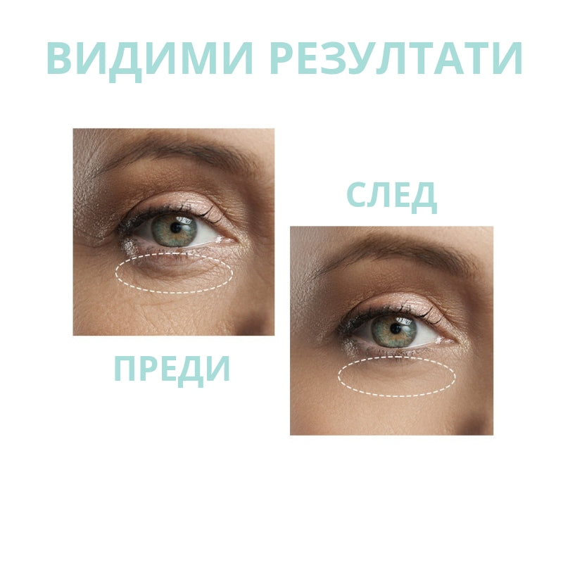 Околоочен лифтинг серум с Ретинол OOTD Wrinkle Lift Eye Serum R+