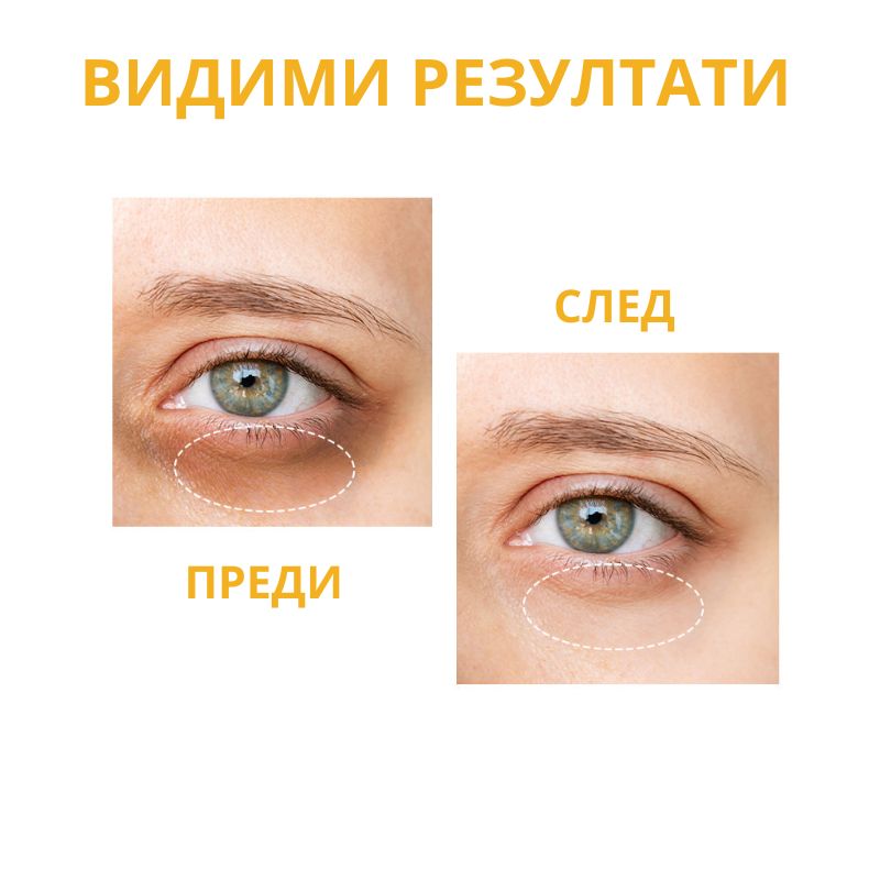 Околоочен серум против тъмни кръгове с Ниацинамид OOTD Dark Circle Eye Serum VC+