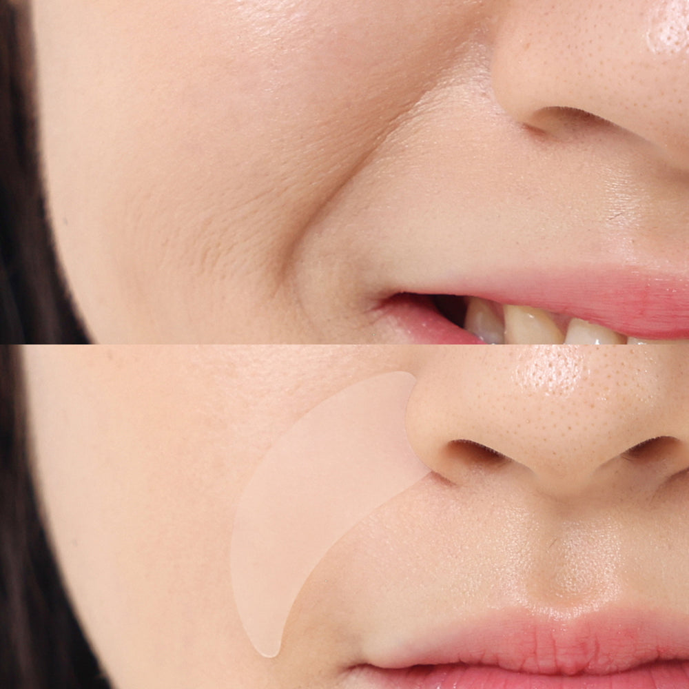 Хидрогел пачове изглаждащи линията на усмивката MADFORCOS Wrinkle Master Patch : Smile Line