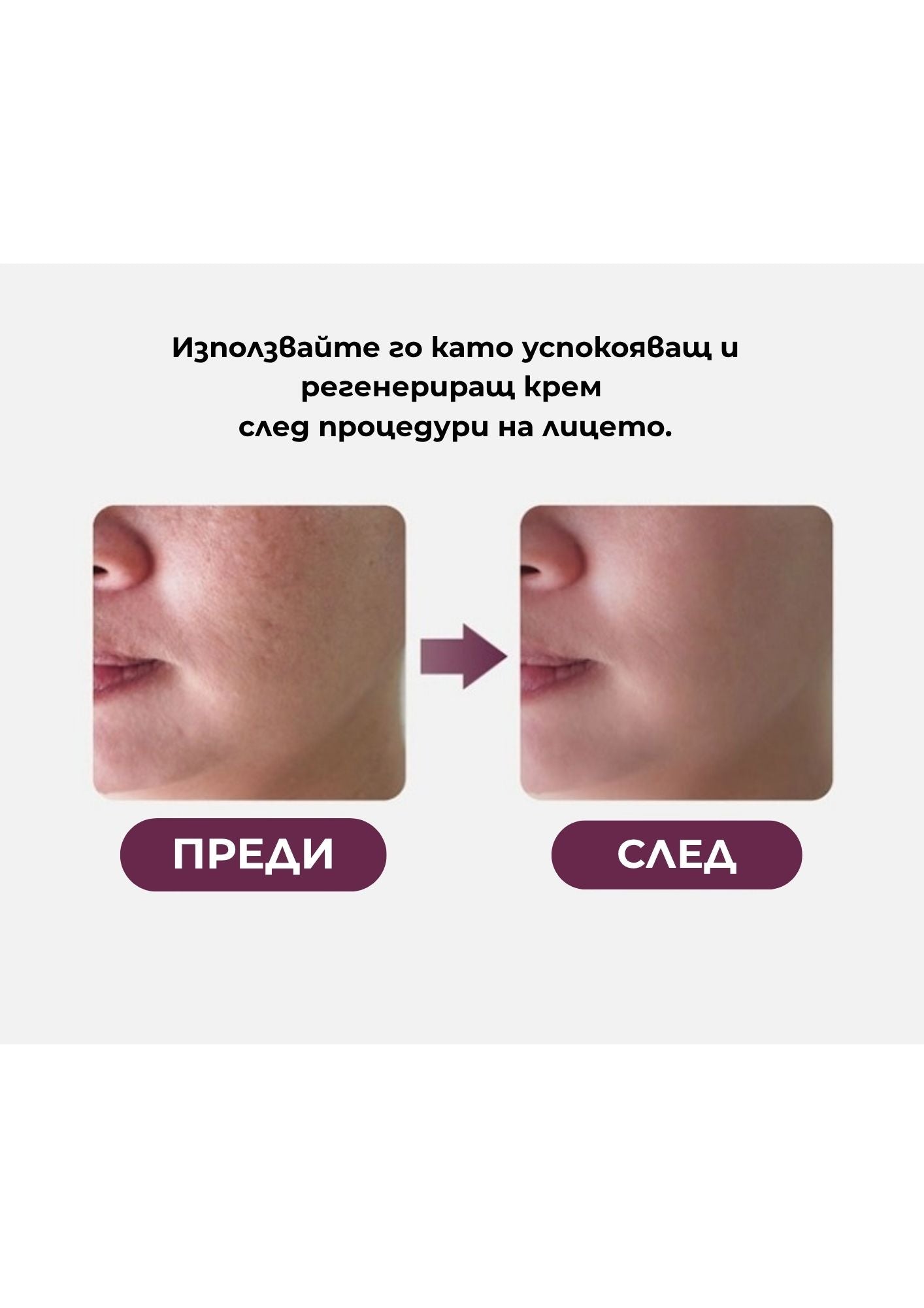 PDRN Хидратиращ крем за клетъчна регенерация VAMPIRE Cream Poul La Peau