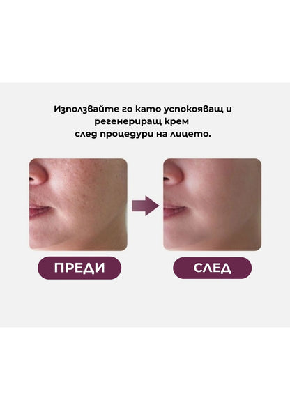PDRN Хидратиращ крем за клетъчна регенерация VAMPIRE Cream Poul La Peau