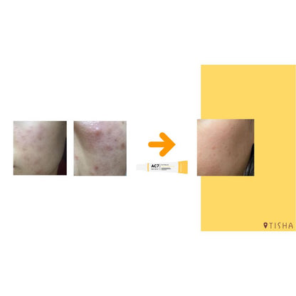 Dr. Tisha AC7 Анти акне серум с микроигли 3 х 1 g