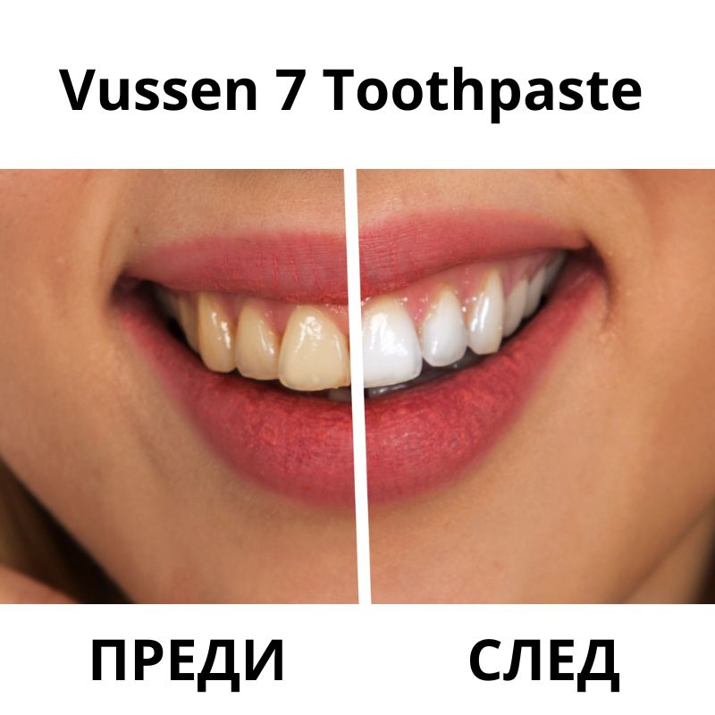 Избелваща паста за зъби с водороден пероксид 0,75% Vussen 7 Toothpaste
