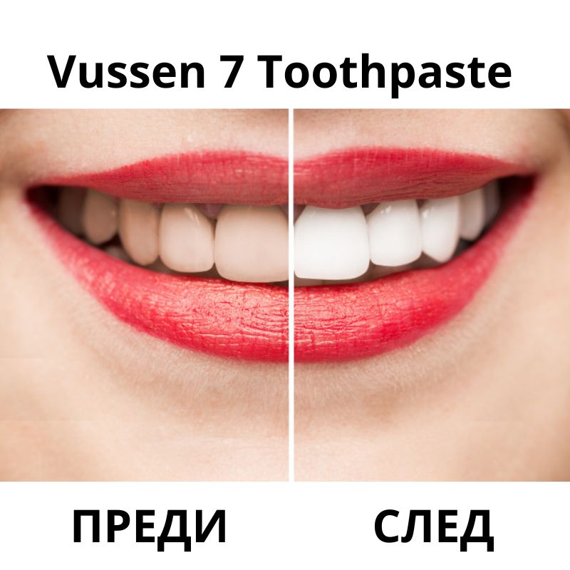 Избелваща паста за зъби с водороден пероксид 0,75% Vussen 7 Toothpaste