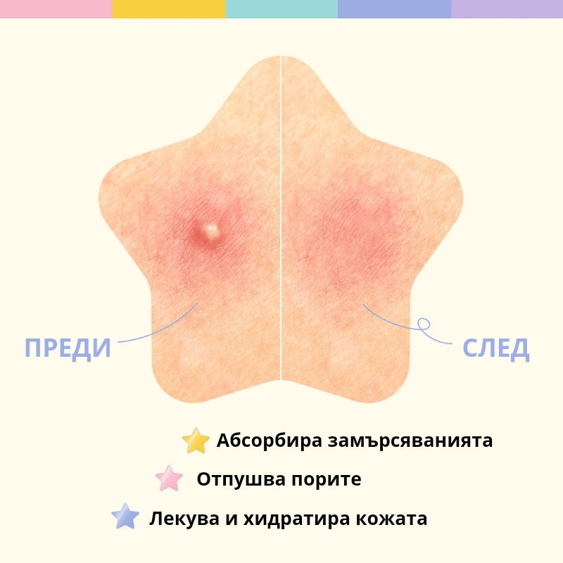 Хидроколоидни стикери против акне с Ниацинамид OOTD Star Spot Patch