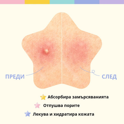 Хидроколоидни стикери против акне с Ниацинамид OOTD Star Spot Patch