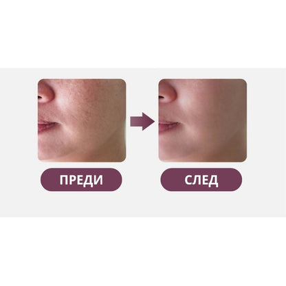 PDRN Хидратиращ крем за клетъчна регенерация VAMPIRE Cream Poul La Peau