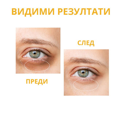 Околоочен серум против тъмни кръгове с Ниацинамид OOTD Dark Circle Eye Serum VC+